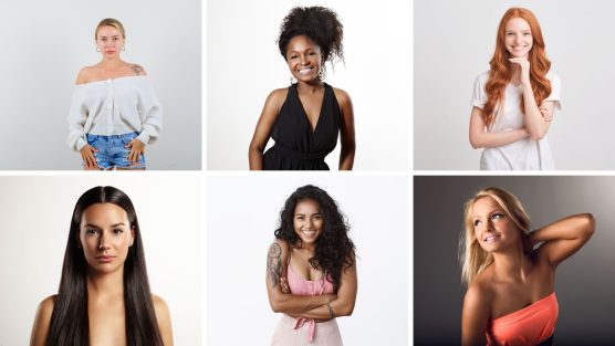 Saiba como identificar o fototipo de pele pra melhor adequar a solução bronzeadora
